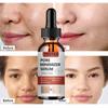 Vitamin C Retinol Firming Serum, Firming Lifting Essence, Softens Skin, Improves Elasticity,  Smoothes Wrinkles, Skin Care Face Serum For Women