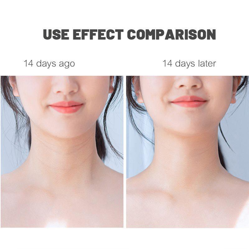 10 шт./компл. маска для шеи с козьим молоком, укрепляющая против морщин, увлажняющая, исчезающая, тонкие линии, патч для шеи LM