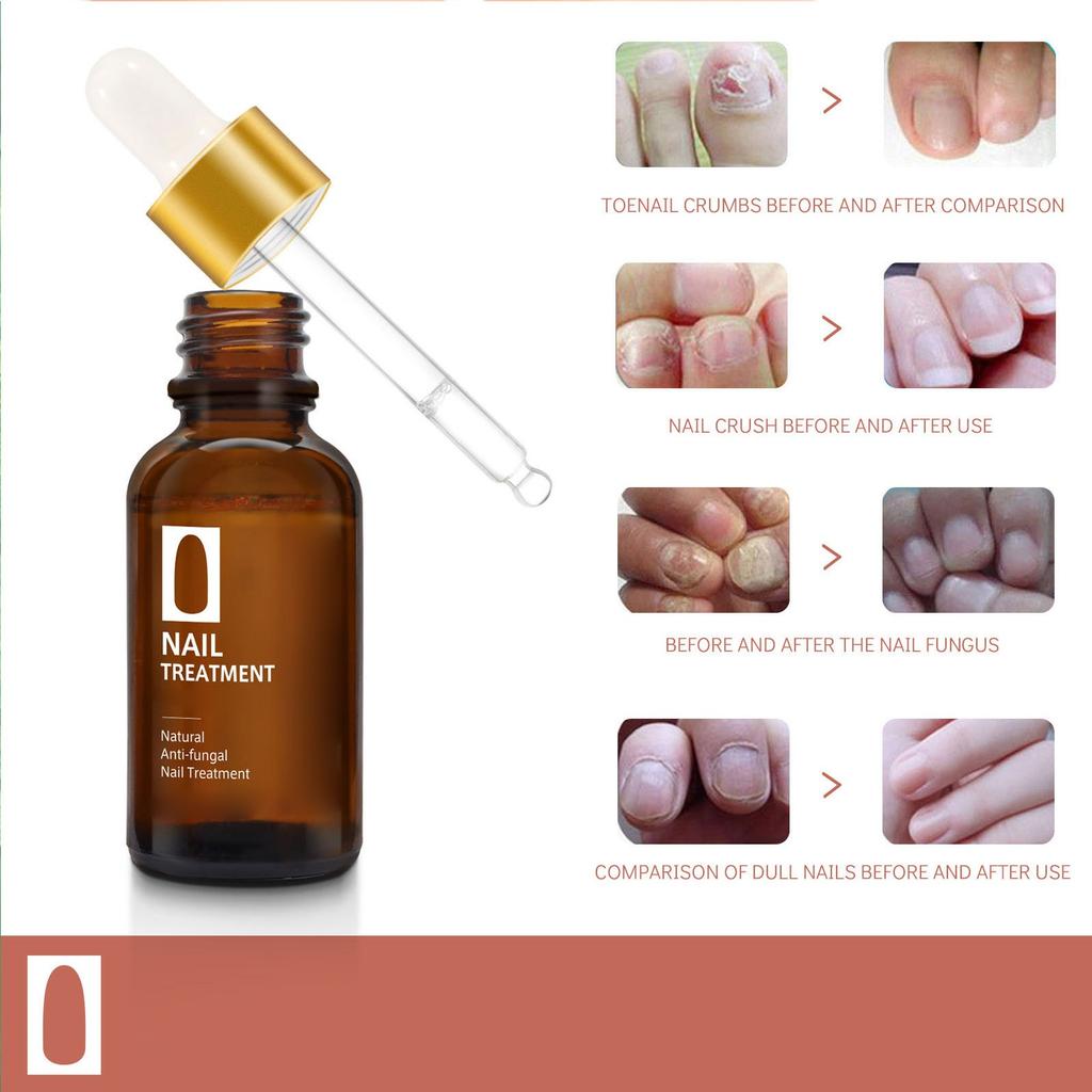 Крем-масло для ухода за ногтями, травяное растение, крем-масло для ухода за ногтями серого цвета для рук и ног, 30 мл