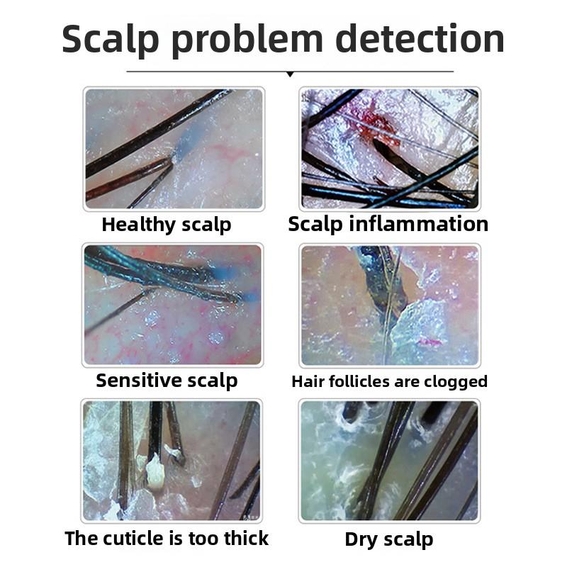 Интеллектуальный прибор для обнаружения кожи головы, детектор пор волосяных фолликулов с ультравысоким разрешением и синим светом, тестер кожи