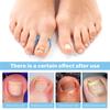 Ingrown Toenail Corrector Stickers, Ingrown Toenail Tool Pieces Ingrown Toenail Lifter and File Nail Patches For Ingrown Toenail