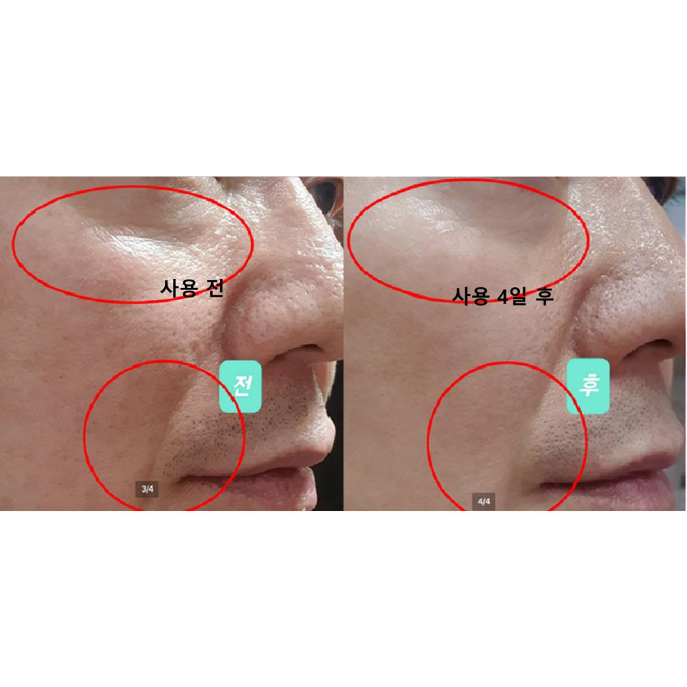 [Пищевая добавка для здоровья кожи, созданная фармацевтом] Программа ухода за кожей ONGI earthy