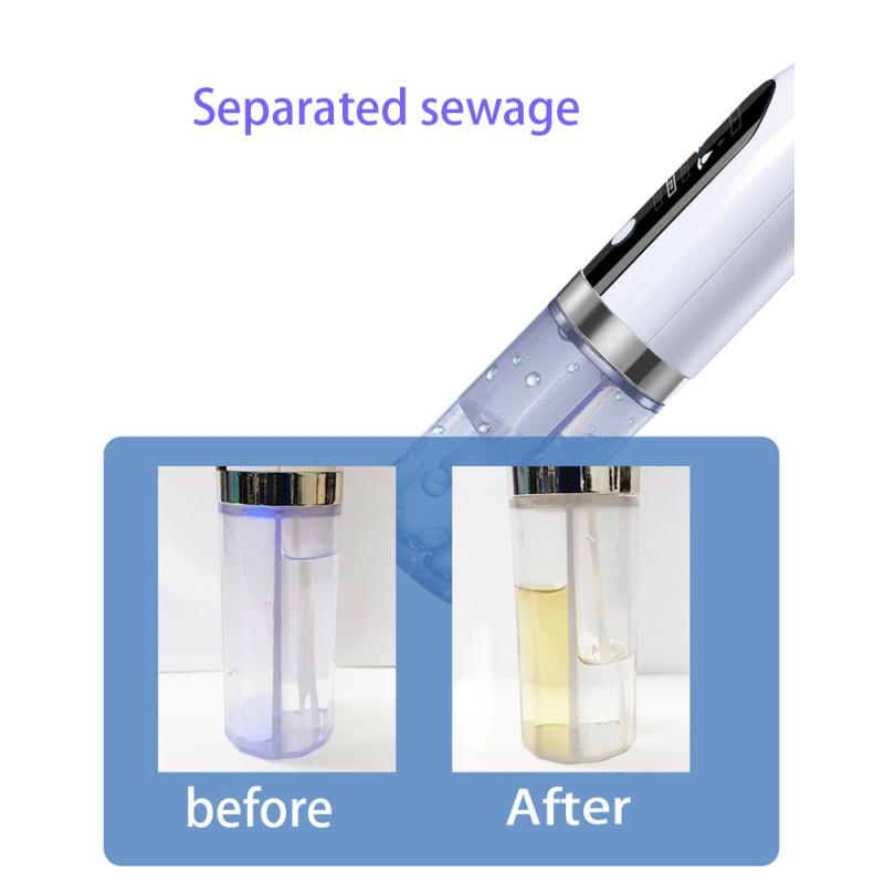 Electric Blackhead Remover Vacuum - USB Rechargeable Pore Cleaner For Facial Cleaning And Pimple Removal