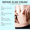 Крем от шрамов, крем для удаления шрамов для мужчин и женщин, разглаживание кожи, укрепление и исчезновение, глубокое разглаживание кожи, нежное внешнее воздействие всех видов