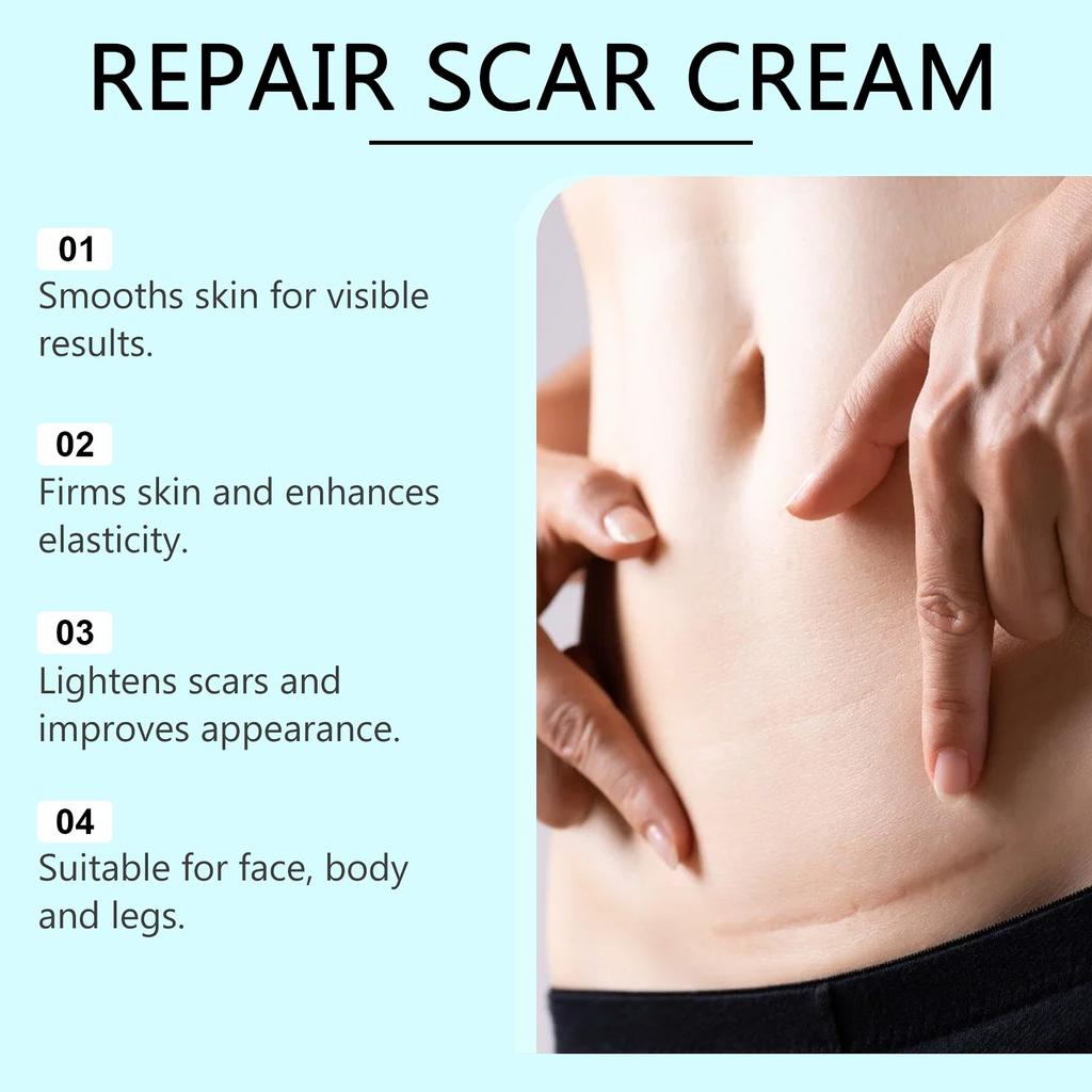 Крем от шрамов, крем для удаления шрамов для мужчин и женщин, разглаживание кожи, укрепление и исчезновение, глубокое разглаживание кожи, нежное внешнее воздействие всех видов