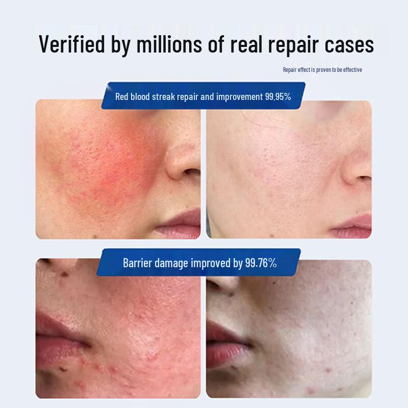 Meiyanfang B5 Repair Cream