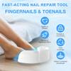 Portable Nail Fungus Treatment Light 22-LED UV Light Therapy for Toenails & Fingernails Foldable U-Shape Design