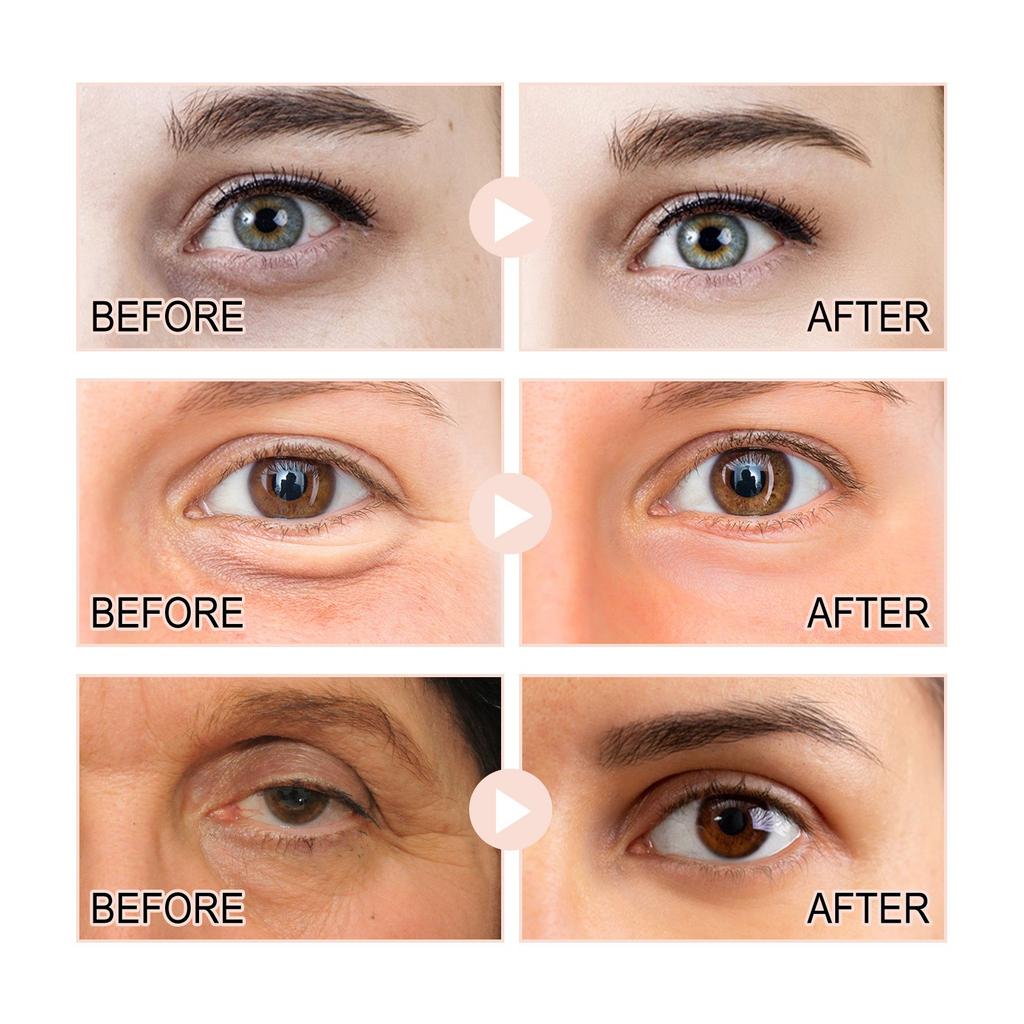 Крем для глаз с ретинолом, разглаживает мелкие морщинки вокруг глаз, убирает мешки под глазами, черные круги, подтягивает и увлажняет кожу вокруг глаз, 30 мл