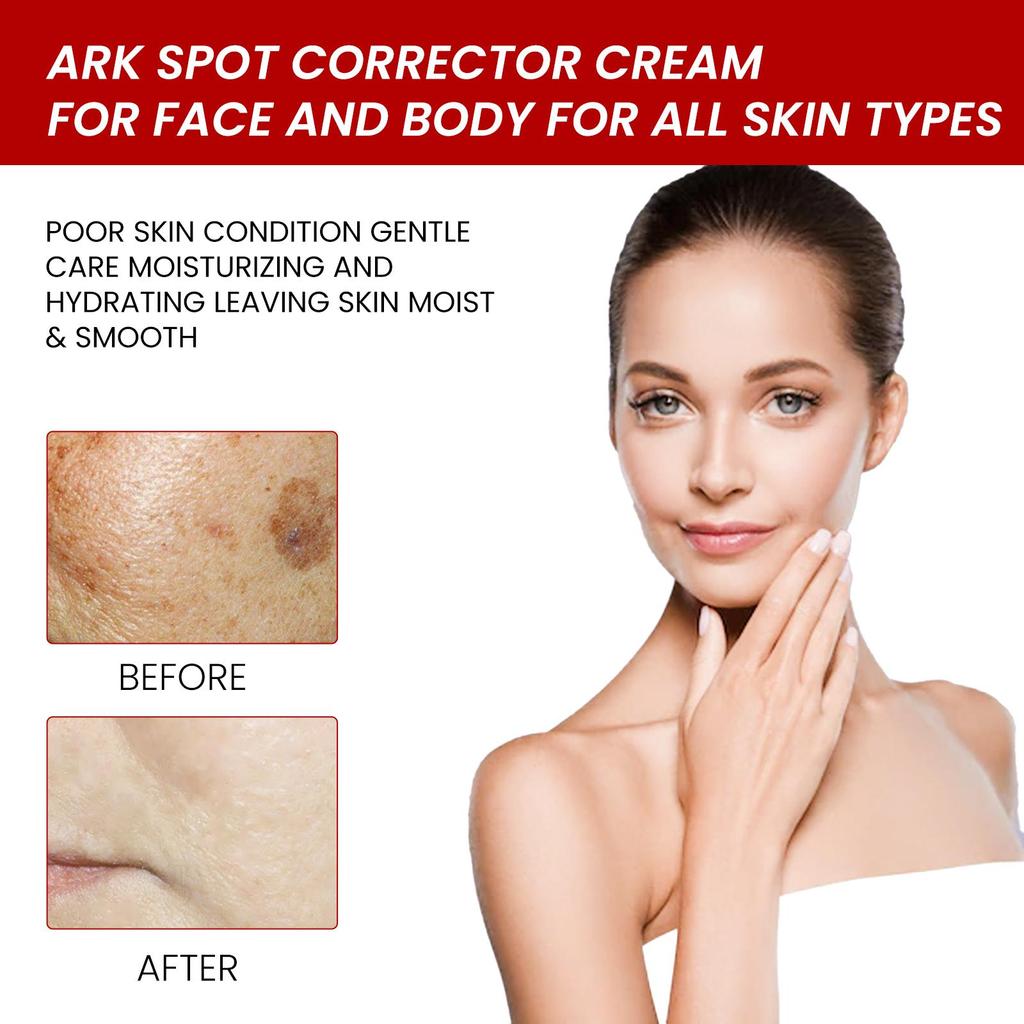 OUHOE Крем для ухода за лицом, осветляет пигментные пятна, увлажняет и питает, восстанавливает кожу, придает сияние и отбеливает. Подходит для использования на лице, 20 г.