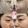 Whitening and Freckle Removing Essence Can Effectively Remove Black Spots. Essence Can Moisturize and Smooth Facial Skin