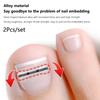2 шт. корректор для вросшего ногтя педикюр восстановление вставка ногтя профессиональный зажим для выпрямления вросшего ногтя скоба