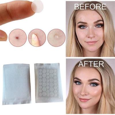 24 шт./36 шт. бирка для удаления кожи, гидроколлоидный пластырь от прыщей, восстановительная подушечка