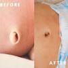 Comfortable To Wear Belly Button Shaper Shape Newborn Baby's Belly Button Silicone Plugs  Women Men