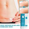 West Month Scar Repair Cream For Reducing Hypertrophic Scars And Pregnancy Marks