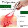 850 нм портативная терапия красным светом, светодиодная терапевтическая ручка, инфракрасная ручка 660 нм, мягкая лазерная ручка для удаления шрамов и морщин, лечение прыщей, 2000 мАч