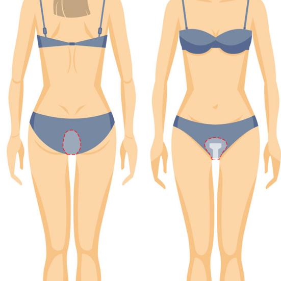 Плавание Приватный пластырь для женщин Водонепроницаемые приватные пластыри Защита от грязи Клейкая наклейка Нежный к коже Ежедневная прокладка для плавания и повседневной деятельности