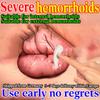 Gentle Natural Hemorrhoid Gel - Soothes Swelling Herbal & Skin-Friendly