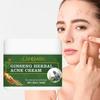 Ginseng Herbal Acne Cream- 24-Hour Long-Lasting Oil Control and Anti-Pimple Protection for Sensitive Skin, 50g