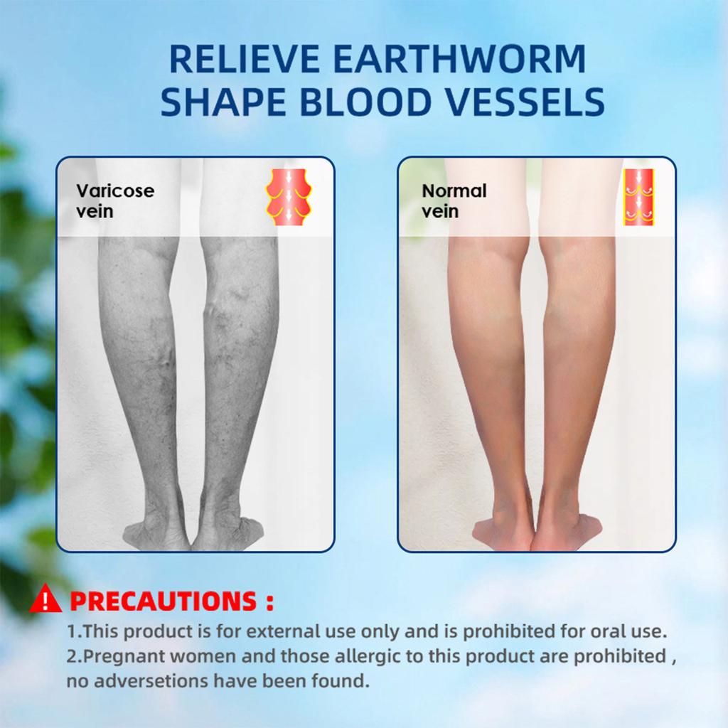 Vein Care Cream Mai Li Shu Ointment Earthworm Legs Spider Varicose Veins 20g