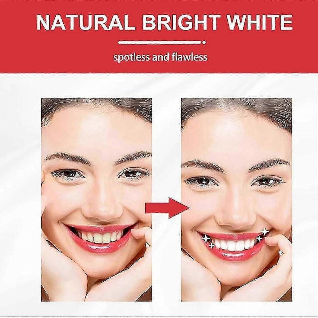 2025 Sp 10 Toothpaste, Sp-10 Toothpaste, Ultra Whitening Toothpaste Sp-10, Sp-10 Probiotic Brightening Whitening Toothpaste, Fresh Breath