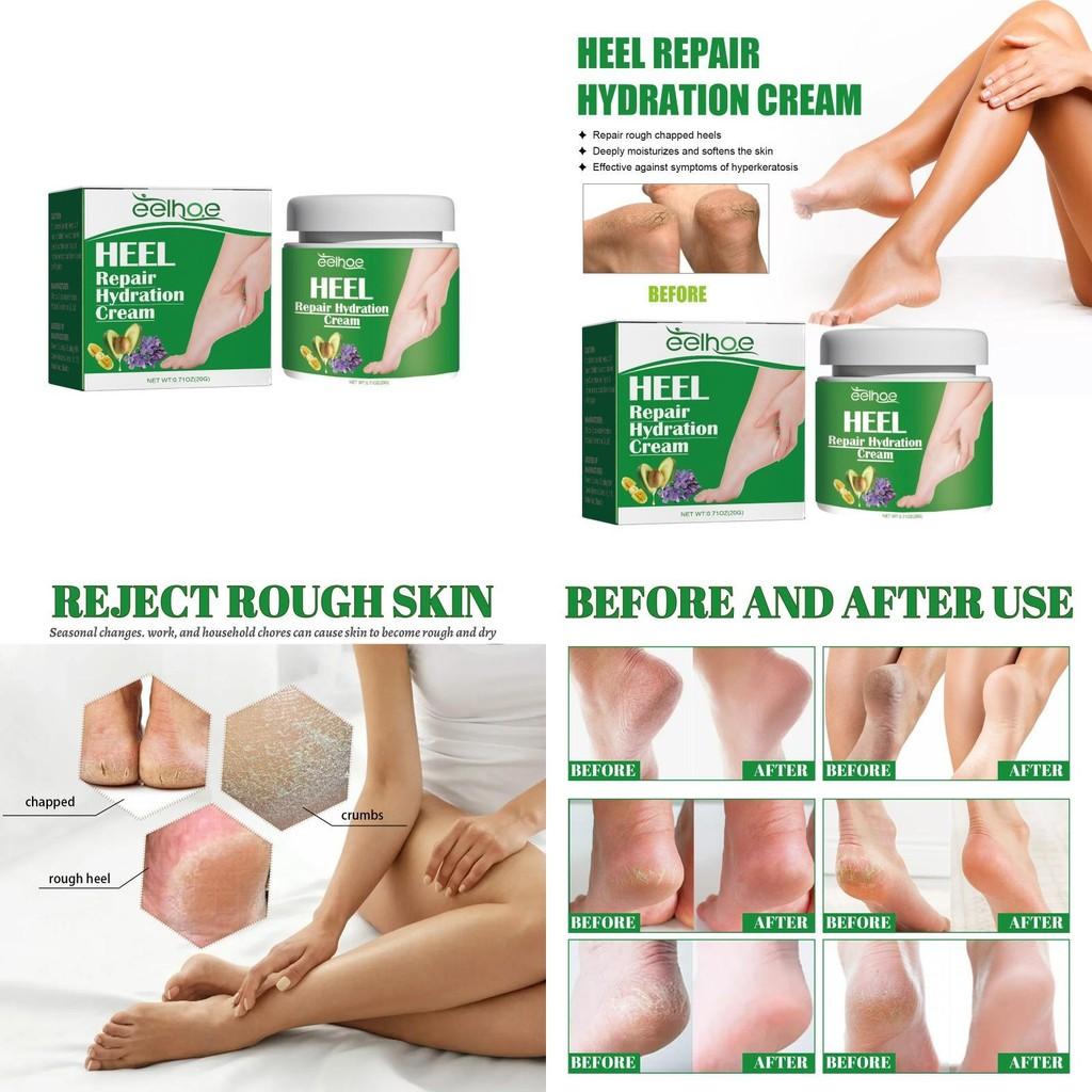 Eelhoe Deeply Nourishing Heel Repair Moisturizing Cream For Soft Silky Feet 20g