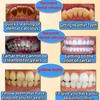 100g Whitening Toothpaste Remover Dental Calculus Whitening Teeth Mouth Odor Removal Bad Breath Preventing Periodontitis