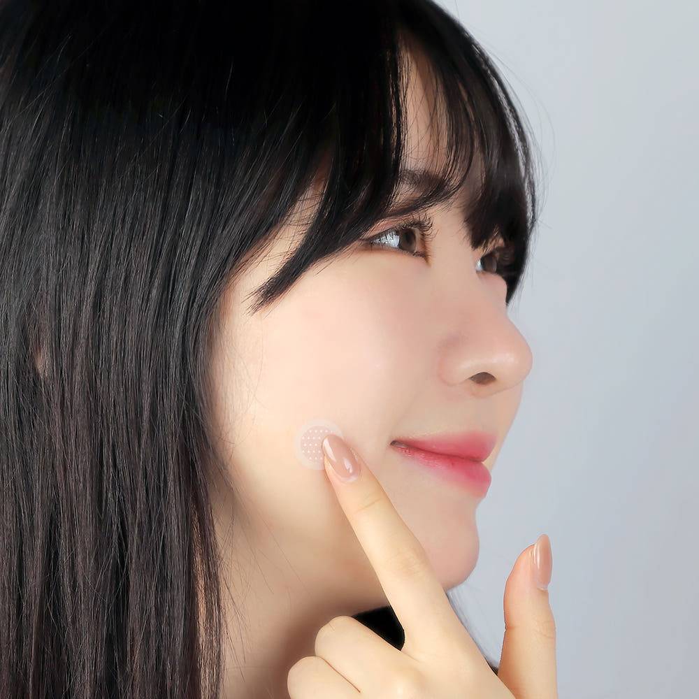 Пластырь с микроиглами QUEENTOX Acne Anti-Trouble 12 шт.