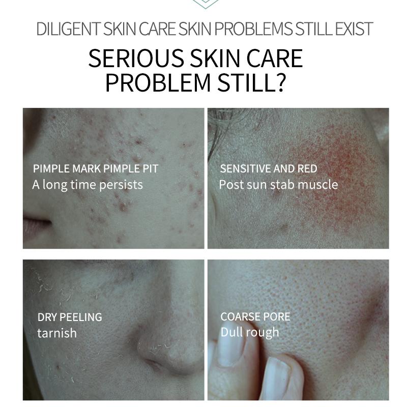 MERCILEN Гель-эссенция алоэ вера, 300 г, увлажняющий и увлажняющий восстанавливающий гель после загара, уход за лицом, гель-эссенция алоэ вера, увлажняющий и увлажняющий гель-эссенция