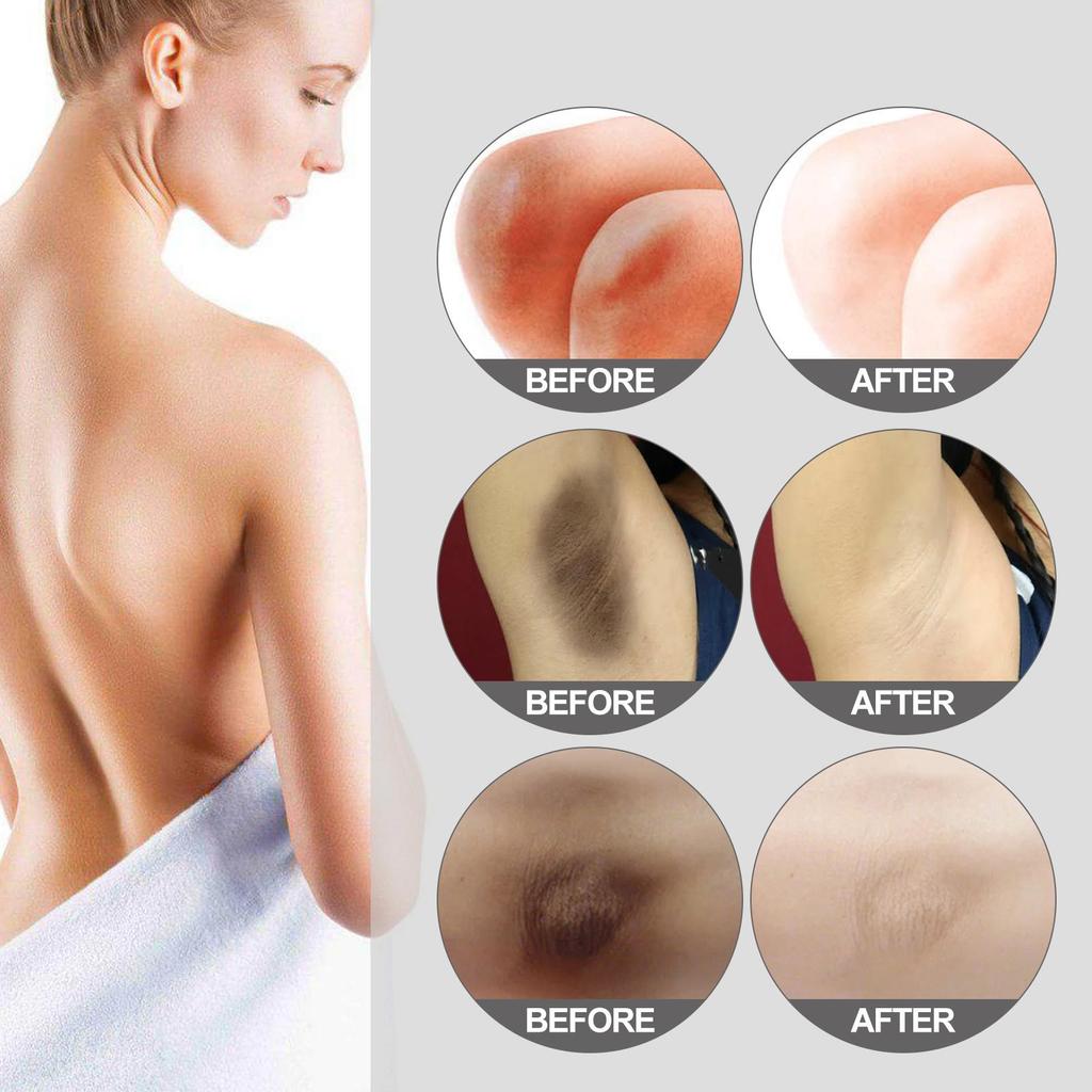 OUHOE Thigh Brightening Moisturizing Cream Hydrating & Radiant Cream for Underarms, Thighs, Knees & Joints 30g