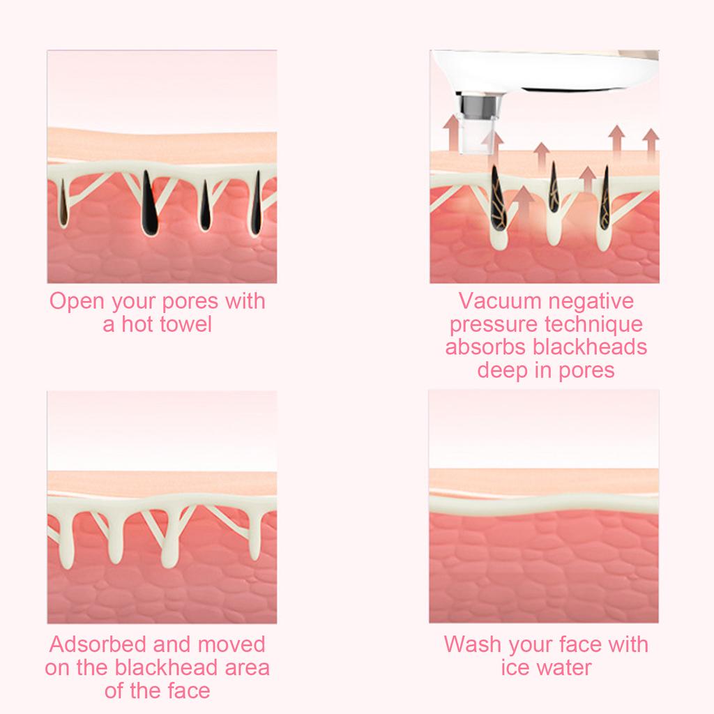 Электрический аппарат для удаления черных точек 3 силы глубокое очищение пор кожи пылесос белый