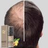 Hair Growth Essence Advanced Thinning Hair & Hair Loss Supplement 20ml Multicolor