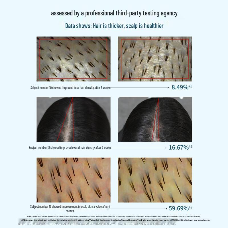 Шампунь Fortro против выпадения волос и для контроля жирности