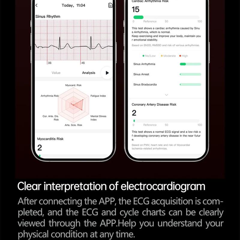 2025 New Health Trackr Uric Acid Blood Lipids Smart Watch Blood Pressure ECG+PPG Clock Body Analysis Smartwatchs Men Emotional Detection