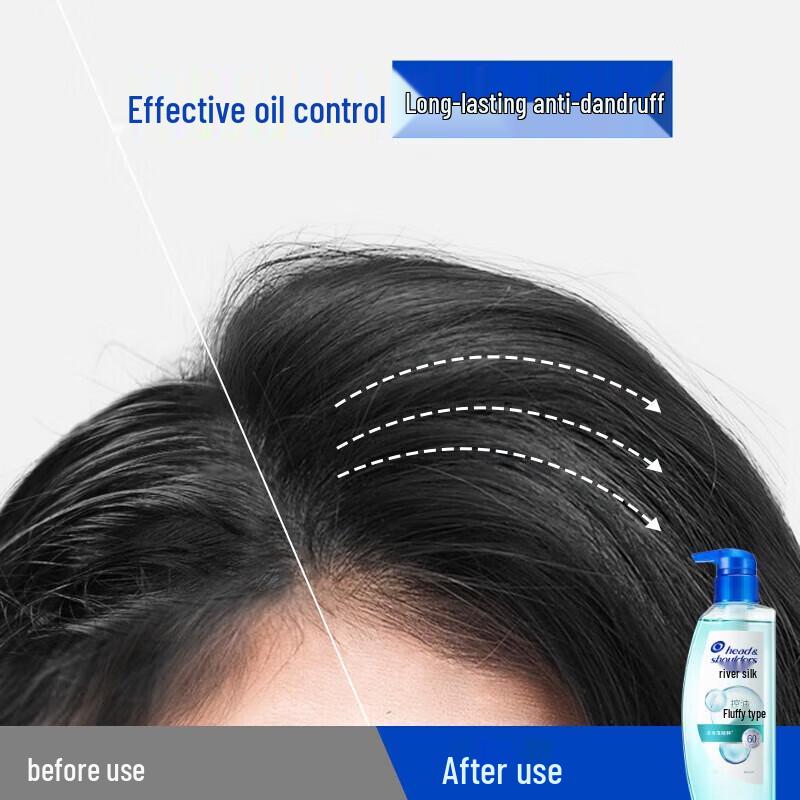 Head & Shoulders Oil Control Volumizing Anti-Dandruff Shampoo