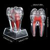 With Base Dental Anatomical Structure Tooth Disintegration Ornaments  Practice Studying Tool