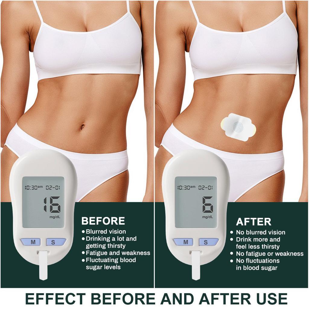 Пластырь от диабета, пластырь для здоровья, для снижения уровня сахара в крови, гипогликемический пластырь, пластырь для пупка, Ancient Light Luxury