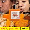 Tumeric Soap Turmeric Cream Whitening Ance Blemish Corrector Dark Spots Brighter