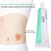 60G Skin Care Powder Stoma Accessories After Surgery Cream Tool Barrier Paste Leak-Proof For Ostomy Bag Anti Ointment