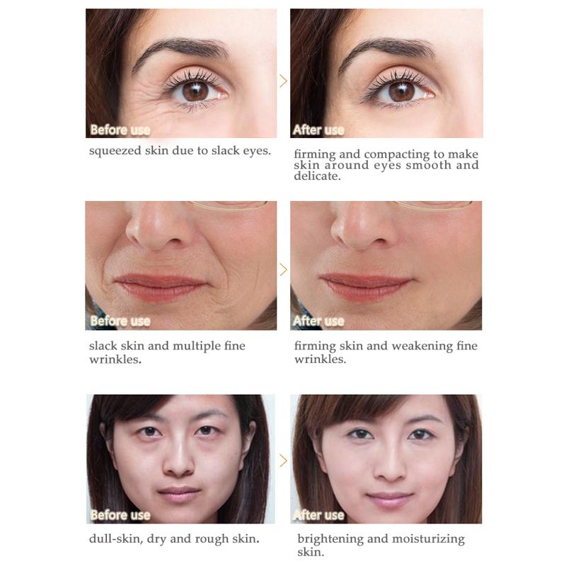 Мультивосстанавливающий крем для лица с улиткой + пептидный крем против морщин для лица ARTISCARE, 2 шт./лот, увлажняющий уход за кожей