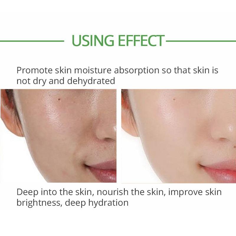 Увлажняющий крем-сыворотка с чайным деревом, крем против прыщей, сужение пор, крем для лица, контроль жирности, увлажнение, гладкость, восстановление, уход за кожей