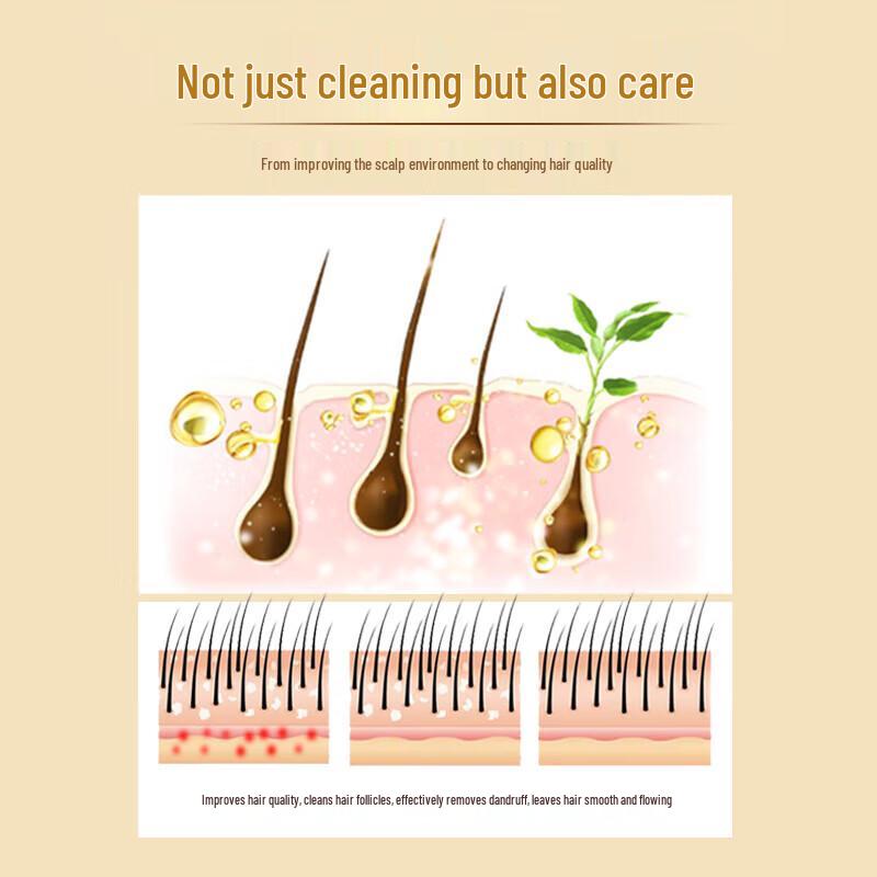 Shilang Ginger Anti-Dandruff & Repair Shampoo