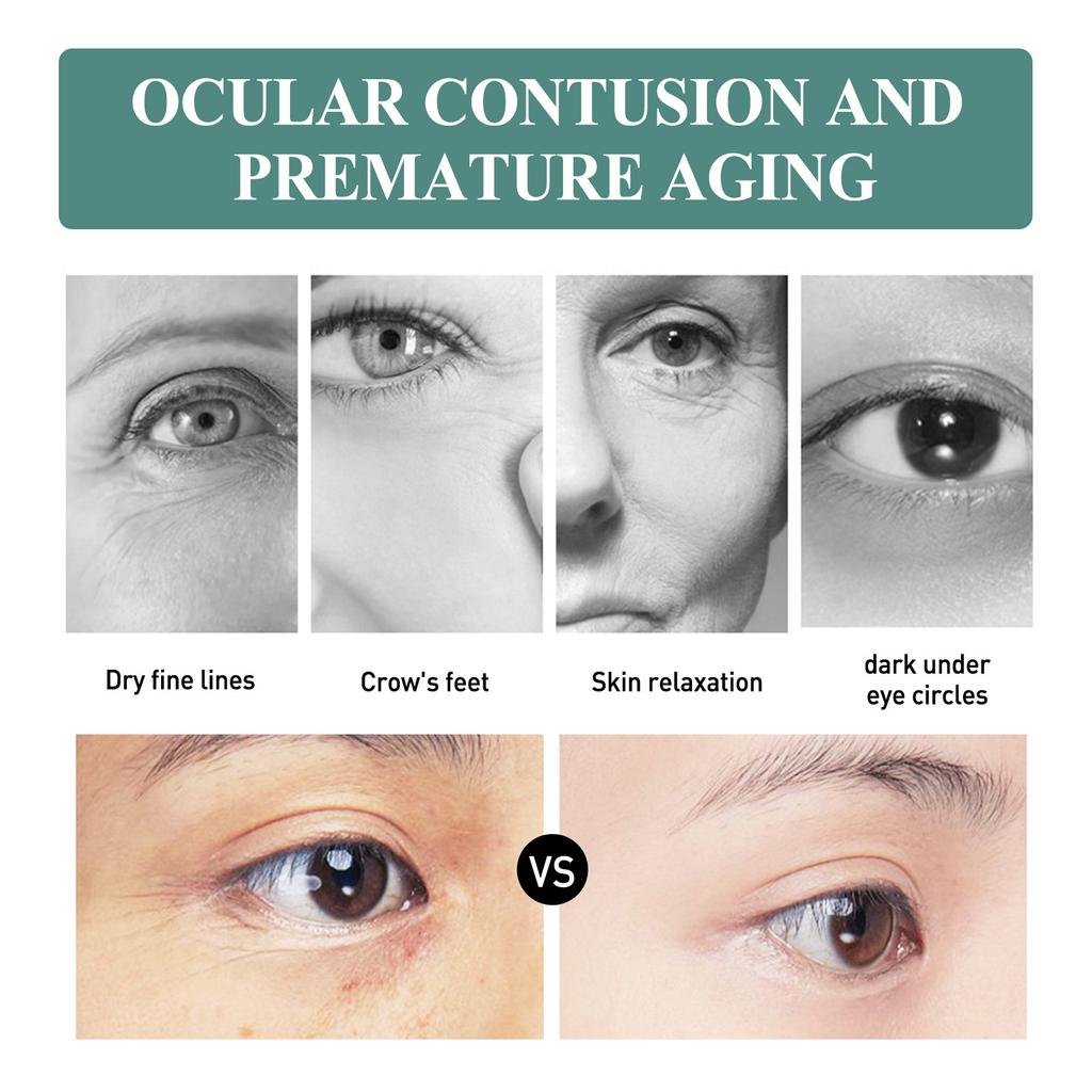 Крем для кожи вокруг глаз против морщин EELHOE Уход за кожей вокруг глаз Уменьшает появление темных пятен Сухие морщины Мелкие морщины Укрепление и восстановление