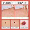 Патчи для ухода за кожей для плоских родинок, патчи для ухода за лицом и кожей вокруг глаз эффективно уменьшают кератин и разглаживают кожу.
