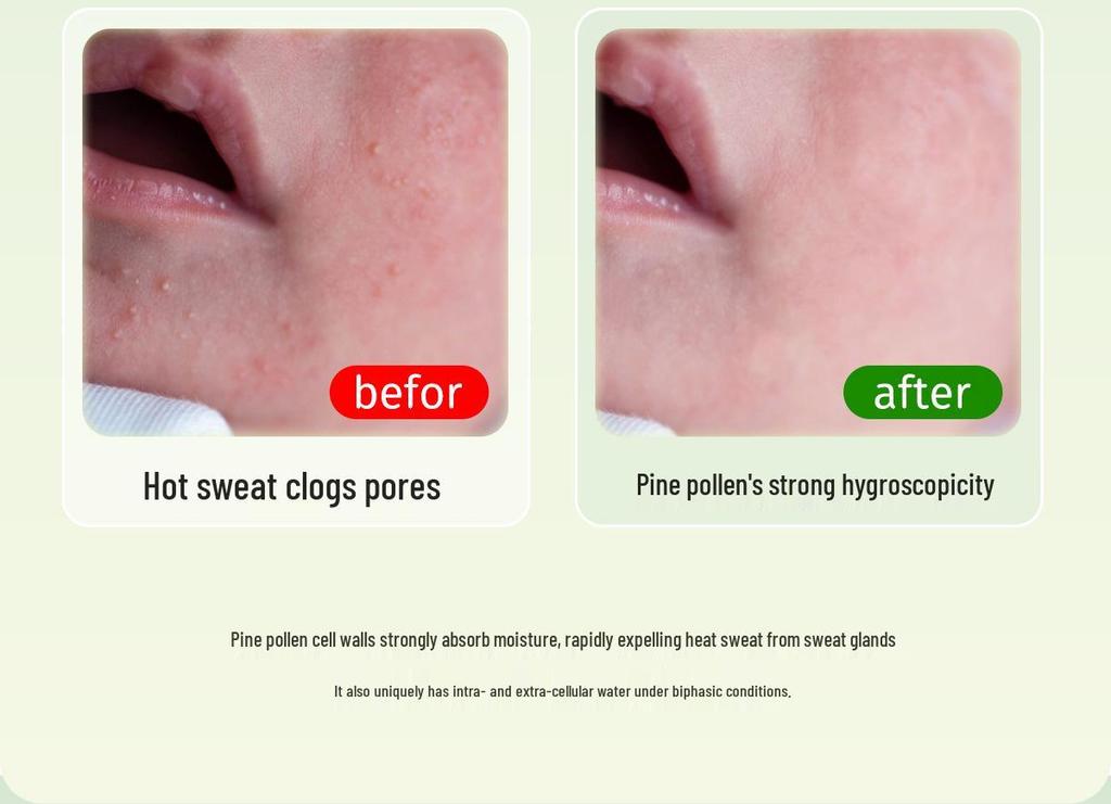 Songda Pine Pollen Prickly Heat Powder for Babies, 52g – Natural Talcum Baby Skincare, Non-Corn Starch.