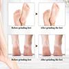 Electric Callus Remover 2-Speed Foot File for Dead Skin Hard & Cracked Heels