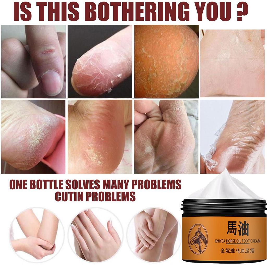 Крем для ног Крем для заживления трещин на пятках Устранение омертвевшей кожи Уход за руками и ногами Увлажняющий крем