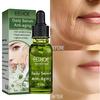 Мгновенное удаление морщин, отбеливающая эссенция, лифтинг, укрепление, увядание лица, тонкие линии, осветление, питание, красота, уход за кожей, увлажняющая сыворотка