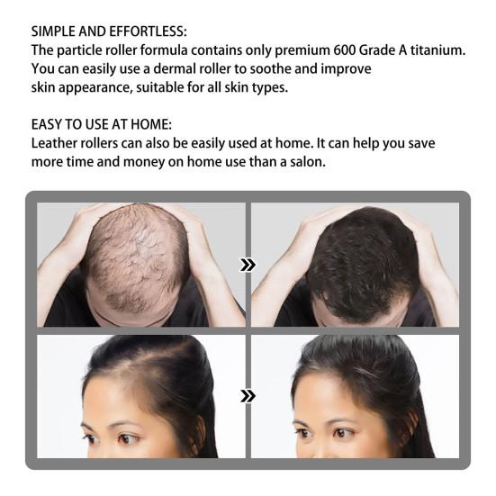 Ролик для роста волос, практичный, прочный, черный, женский, для домашнего использования, набор инструментов для красоты, принадлежности для ванной комнаты