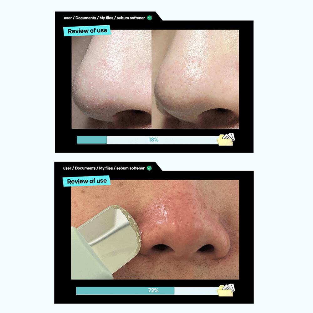 ilso Супер-тающий смягчитель кожного сала 150 мл, специальный набор (Особый подарок: Ватный диск 40P)