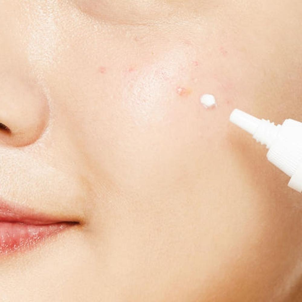 COSRX AC Collection Ultimate Spot Cream 30g